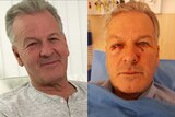 A composite image of a man looking healthy and him with serious eye injuries.