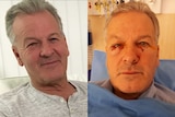 A composite image of a man looking healthy and him with serious eye injuries.