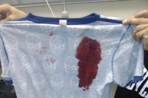 A light blue t-shirt with a patch of blood being held up by someone in a black t-shirt.
