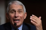 Dr Anthony Fauci listens during a Senate Senate Health, Education, Labor, and Pensions Committee Hearing