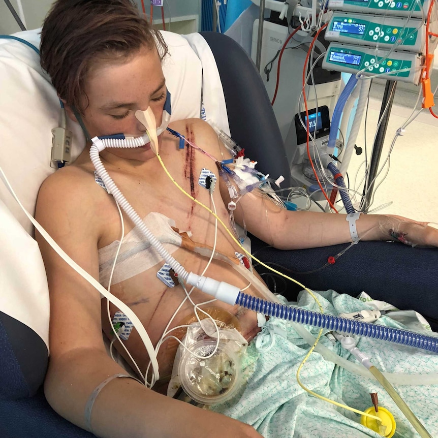A young teenager in a hospital bed with tubes and medical monitors.