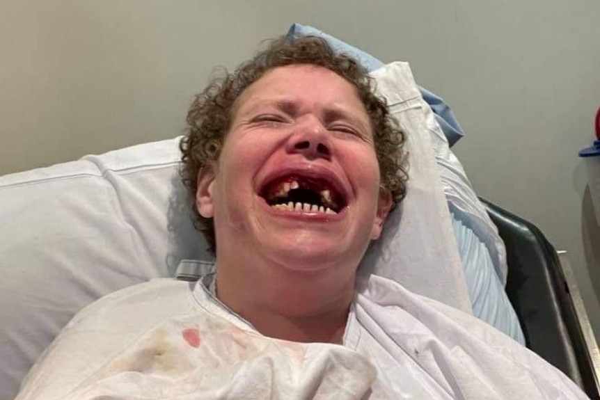 A young woman in a hospital gown appears to wince in pain, eyes closed. Her open mouth shows some front teeth are missing.