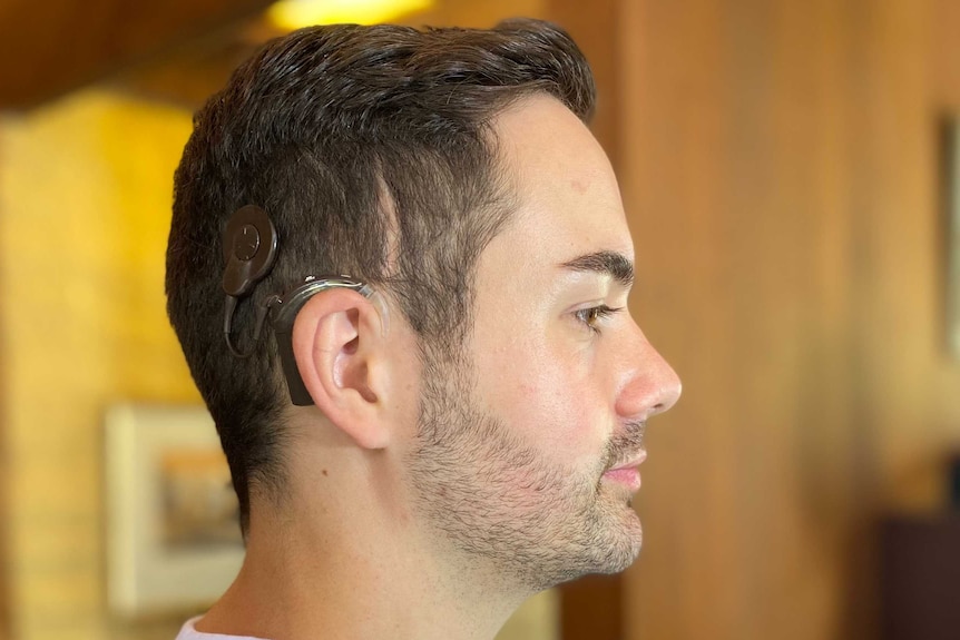A side view of a man's head showing his cochlear implant.
