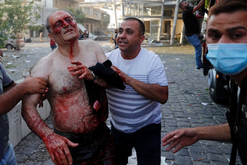 A shirtless, bloody man looks in distress as he is helped by other men