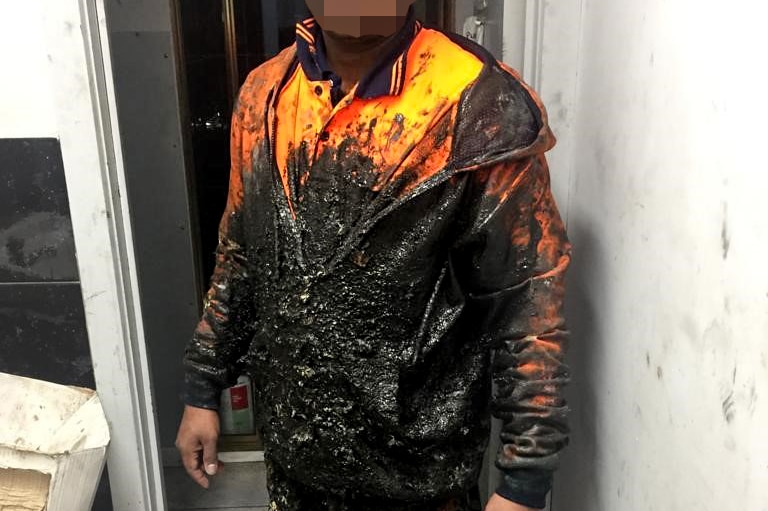 Man in orange cotton uniform covered in black substance with face pixelated.