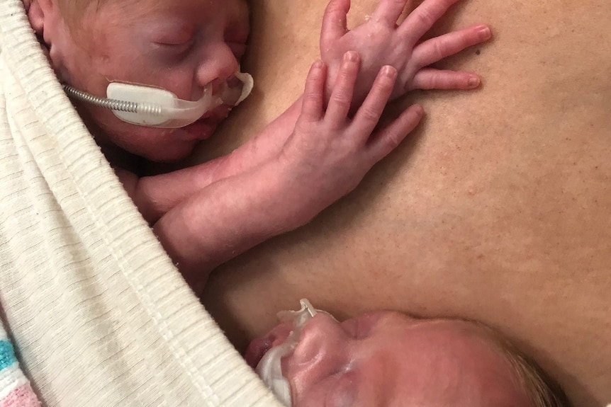 Two preterm babies nestle against their mother's body.