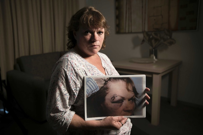 Jonda Stephen holding a picture of her injuries to her head and eyes