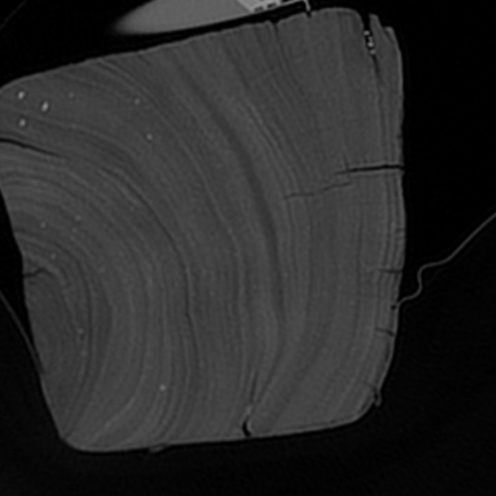 An X-ray of a piece of timber showing grain
