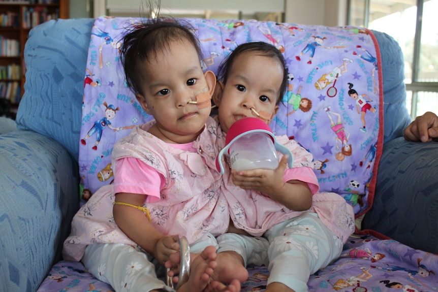 Conjoined twin toddler girls sit on a couch wearing bright pink outfits