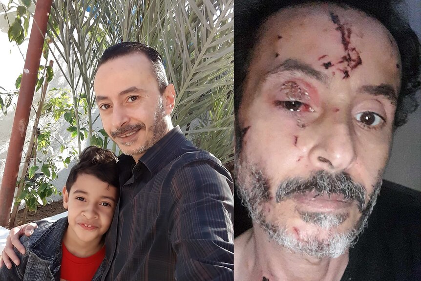 Hazem Sabwai with his son Kareem on one side, and his current injuries on the other.