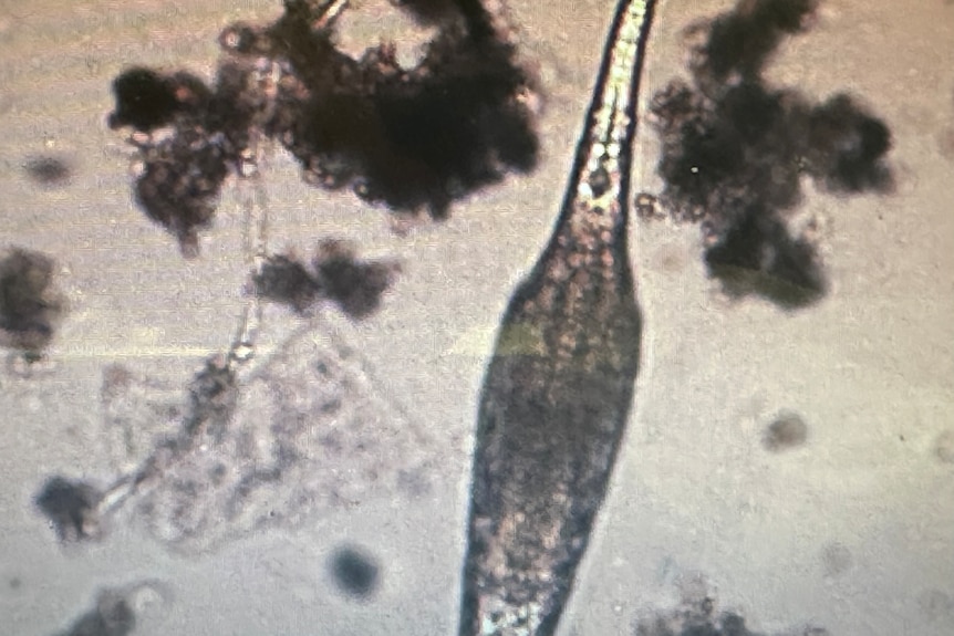 A beneficial soil microorganism seen through a microscope 