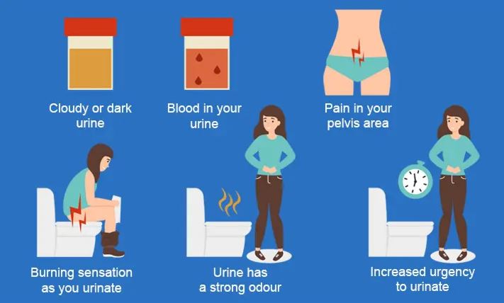 An infographic listing common symptoms of UTI including cloudy urine, stinging while urinating, pain in pelvic area