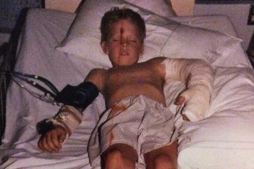 Nick Fredriksen as a child in a hospital bed, arm bandaged