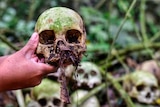 Hands holding up a skull: the forehead is covered in moss and a lead comes out of the nostril cavity.