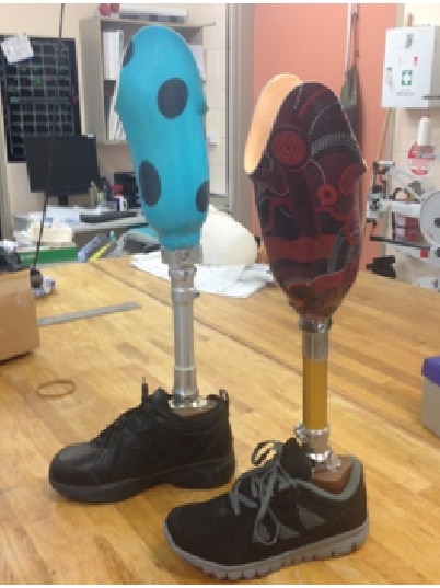 Two artificial legs painted with designs