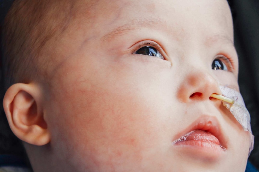 A close-up of baby Leo Yang with a nasal tube in his nose.