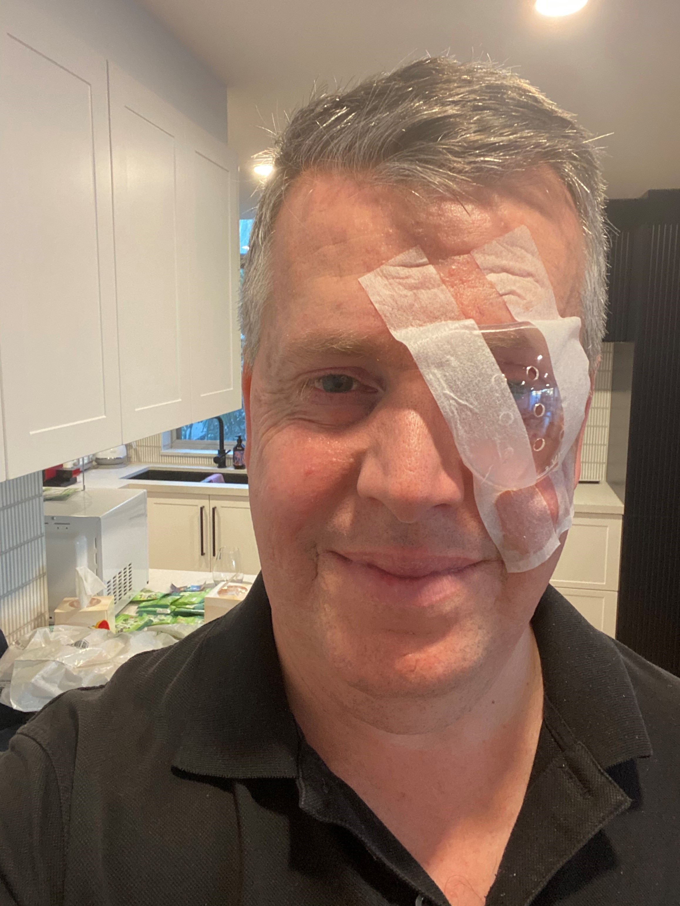 A grey-haired man wears a transparent eyepatch on his left eye.