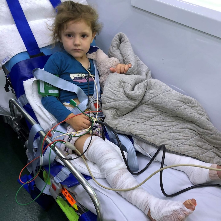 A young girl strapped in bandages in a hospital bed