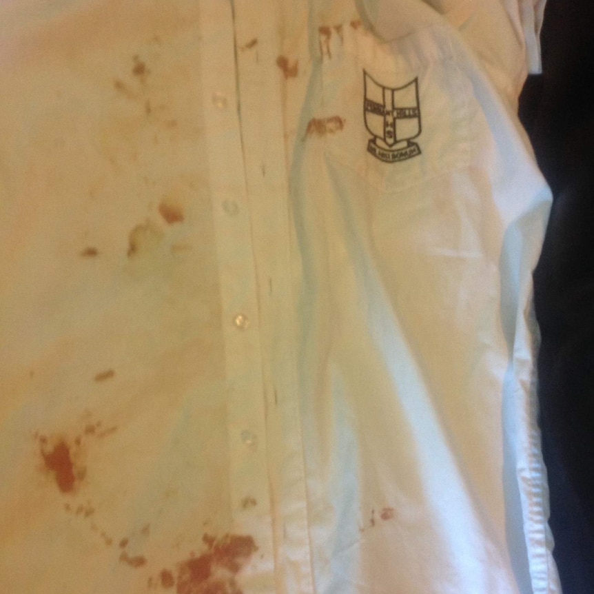 Austin Franks' blood-splattered school shirt