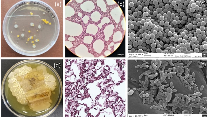 Plates and microscope images of bacteria