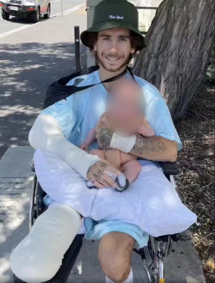 A man with a bandage around his amputated right leg sits in a wheelchair.