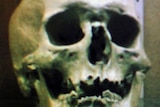 A skull that could belong to notorious Australian bushranger Ned Kelly