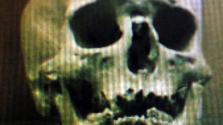 A skull that could belong to notorious Australian bushranger Ned Kelly