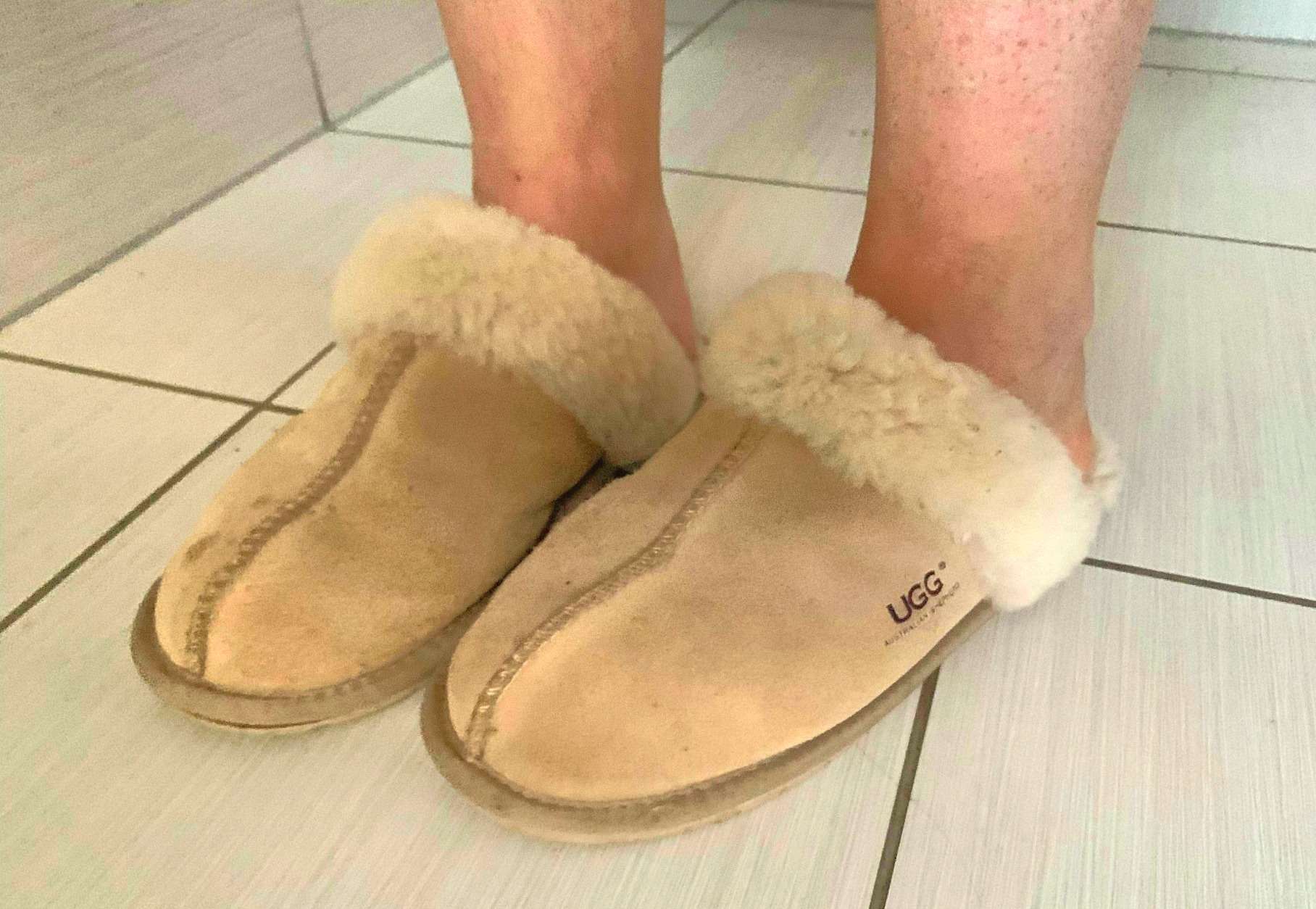 ugg feet