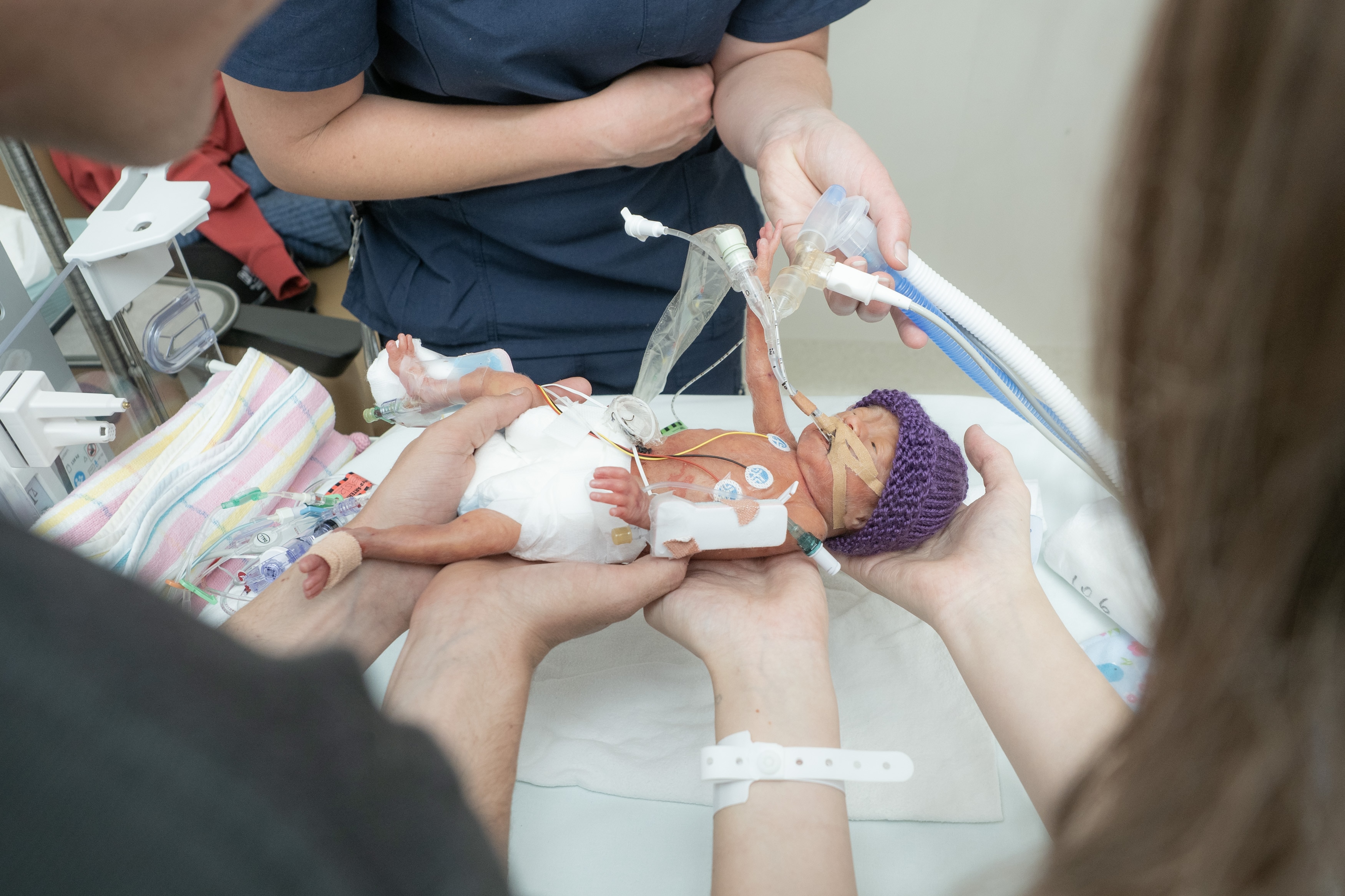 Un bebé en la unidad de cuidados intensivos está en brazos de sus padres.