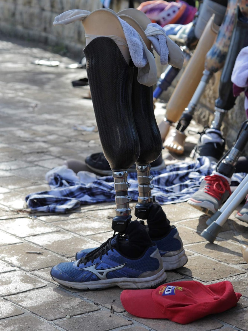 Hand and leg prosthetics are set down near a pool