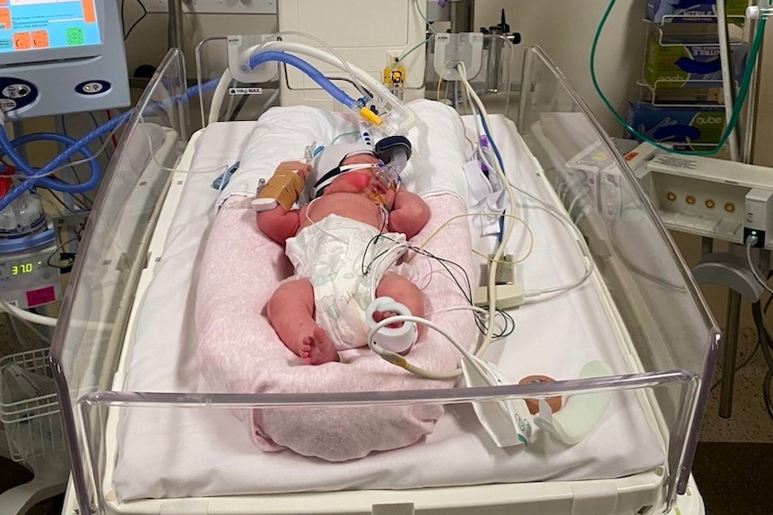 A baby in a hospital bed on a breathing device.