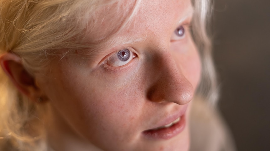 A close-up of a young person's face.