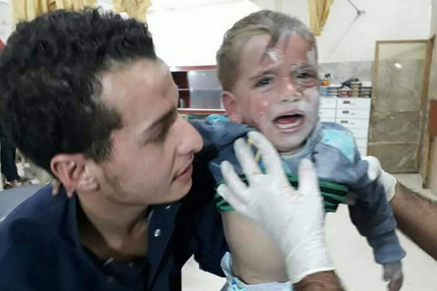 A child who appears to have burns to the face is comforted by medical staff.