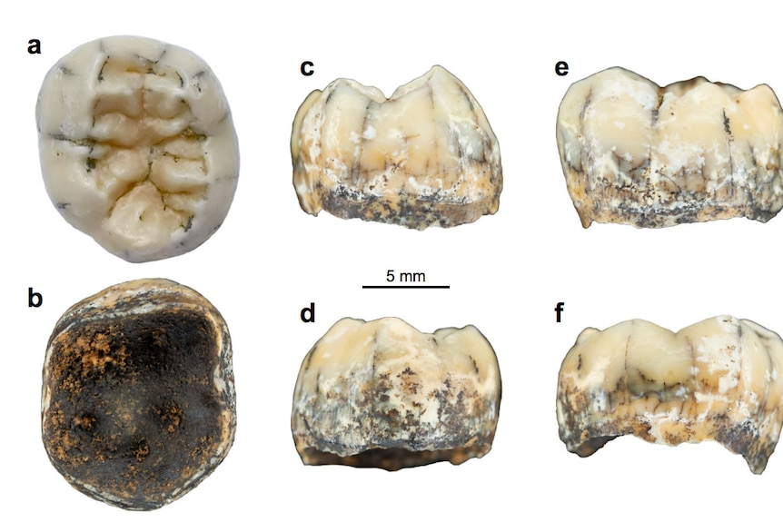 A tooth seen from six angles