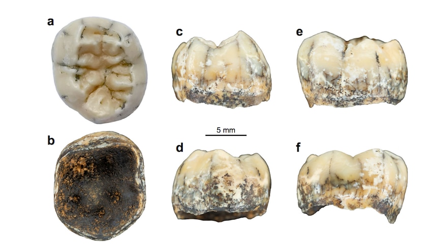 A tooth seen from six angles
