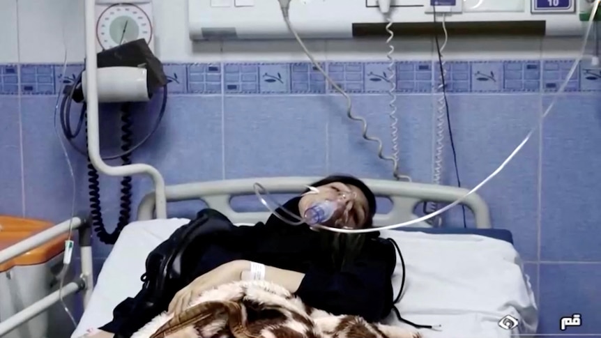 A young woman lies in a hospital bed with a respirator.