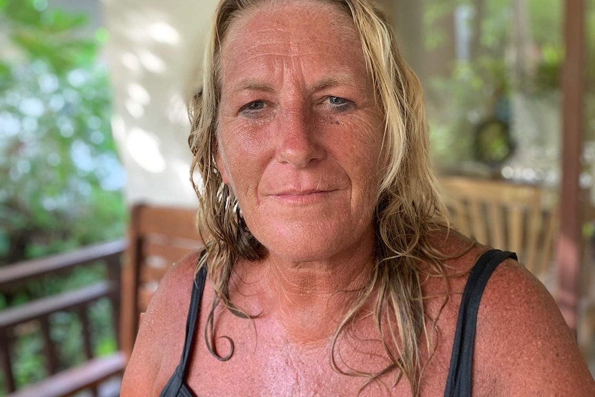 A sunburnt woman stares directly at the camera.