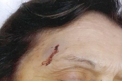 Police said the woman, who does not want to be identified, suffered a serious cut to the face.