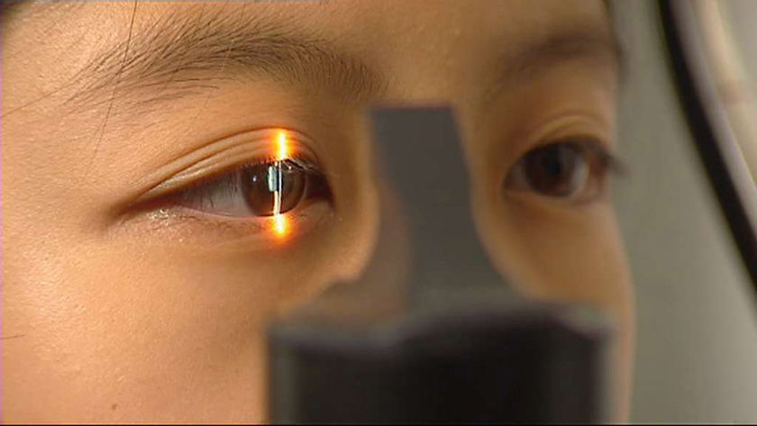 Macular Degeneration