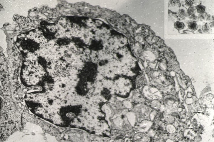 An ATL leukemic cell