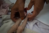 The tiny emancipated legs of a baby are held by an adult's hands on a hospital bed
