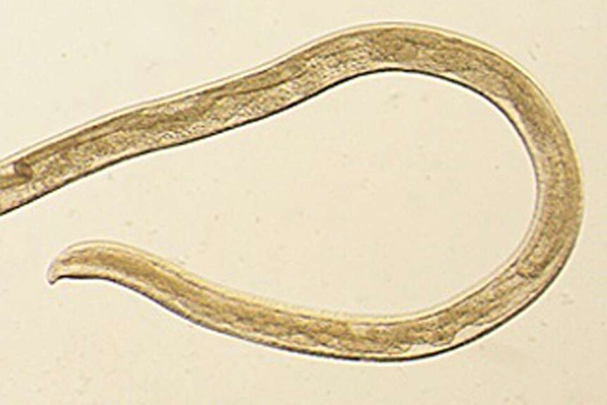 A microscopic image of a worm caused by Thelazia gulosa.