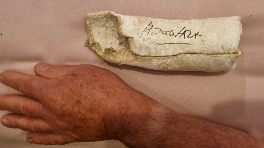 a human arm on a mattress with a small plaster cast alongside it signed in black texta