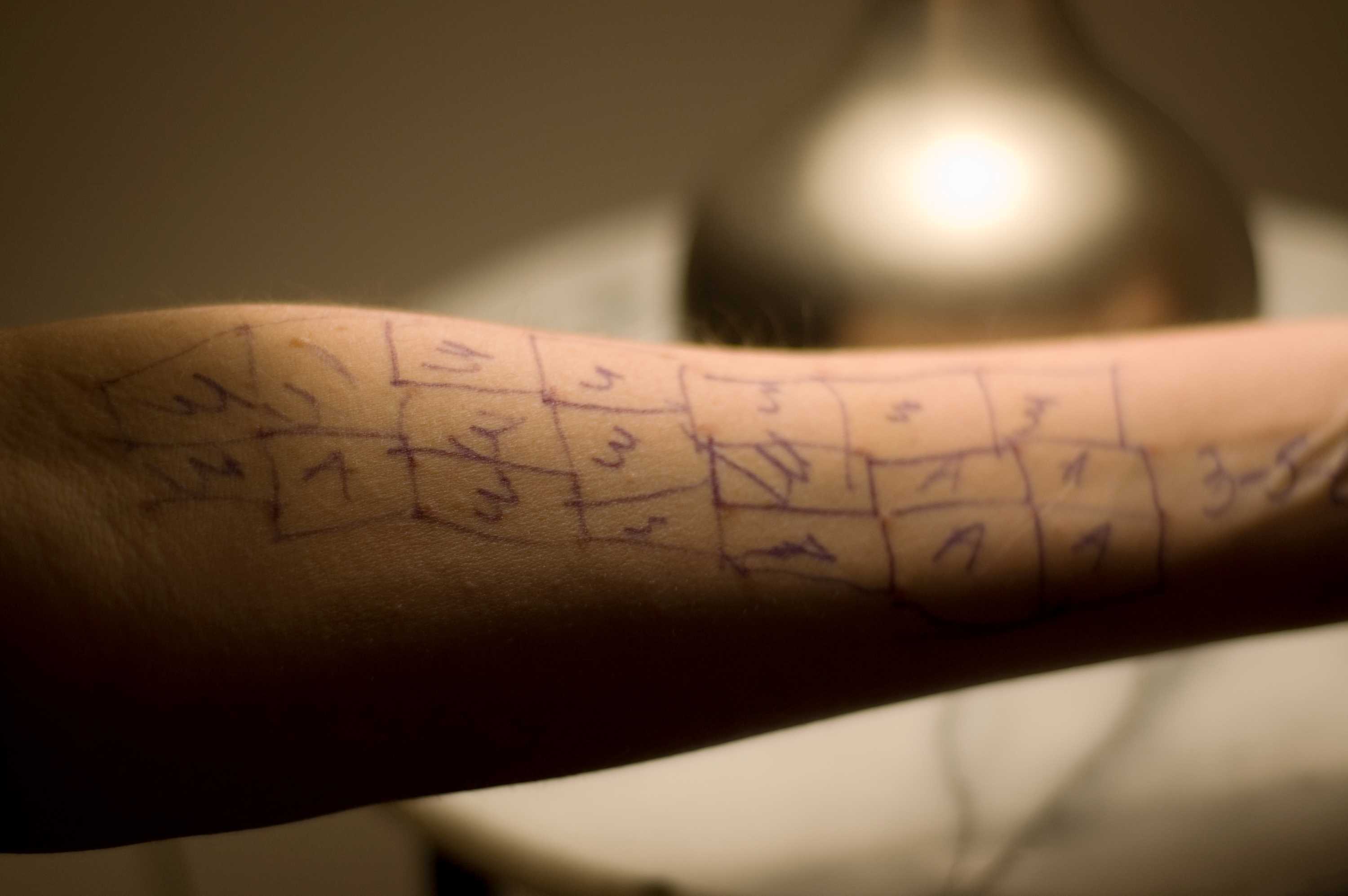 Understanding allergies might help you stop sneezing, itching and