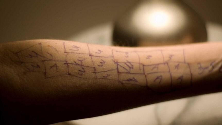 Close up of a forearm covered with red dots and pen markings.