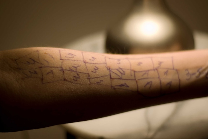 Close up of a forearm covered with red dots and pen markings.