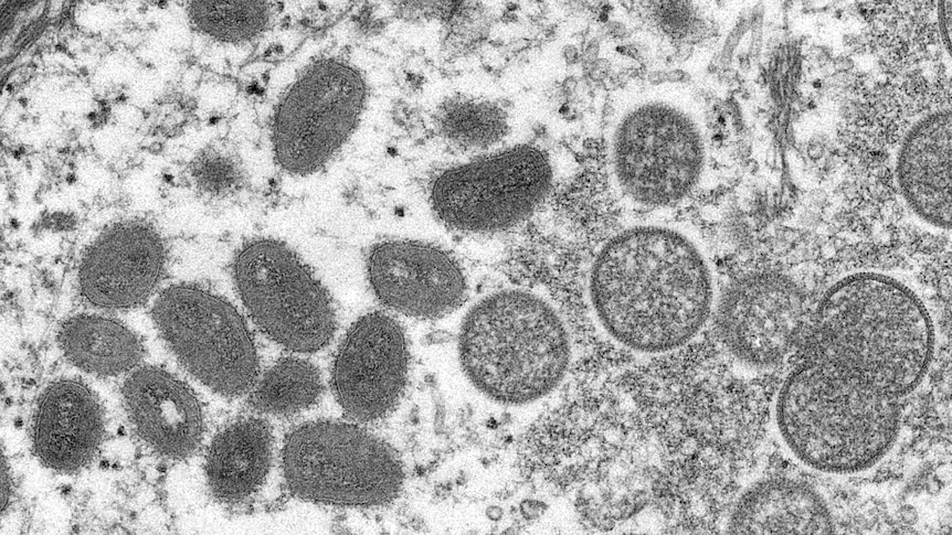 Het Monkeypox virus is bioterrorisme