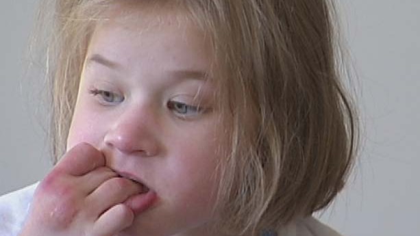 Eight-year-old Alice takes medicinal cannabis to help reduce seizures.