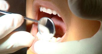 TV still of close-up of open human mouth with dentist examining teeth with dental mirror instrument