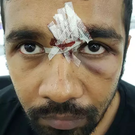 Kamal Pervez with bandages over facial wound
